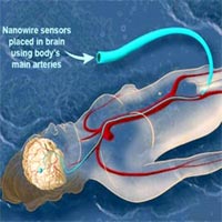 Neuroscientist Rudolfo Llinas and his colleagues envision an entire array of nanowires being connected to a catheter tube, which could then be guided through the circulatory system to the brain. Once there, the nanowires would spread into a kind of bouquet, branching out into tinier and tinier blood vessels until they reached specific locations. Each nanowire would then be used to record the electrical activity of a single nerve cells, or small groups of nerve cells.<br/>
<br/>
Credit: Zina Deretsky, National Science Foundation