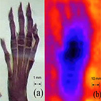 The neutron micrograph at right (b) of a rat's foot uses false color to show differences in the number of neutrons penetrating the sample and hitting a detector. Black areas represent areas with the fewest neutrons; red areas have the most. With future improvements in resolution, such microscopes may provide details about internal structures.
<P>
Credit: Adelphi Technology Inc.