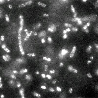 This fluorescence micrograph shows phage-quantum dot complexes (bright spots) bound to E. coli cells (cylindrical shapes). The NCI/NIST method of tagging cells with quantum dots can be used to identify bacteria much faster than conventional methods. The fluorescence signal is strong and stable for hours, enabling scientists to count the number of phage viruses bound to a cell.<br/>
<br/>
Image credit: NCI/NIST