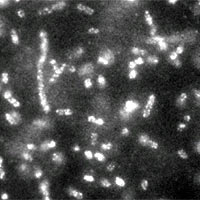 This fluorescence micrograph shows phage-quantum dot complexes (bright spots) bound to E. coli cells (cylindrical shapes). The NCI/NIST method of tagging cells with quantum dots can be used to identify bacteria much faster than conventional methods. The fluorescence signal is strong and stable for hours, enabling scientists to count the number of phage viruses bound to a cell.<br/>
<br/>
Image credit: NCI/NIST